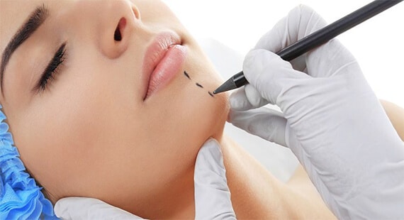Chin Augmentation in Delhi