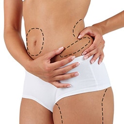 Liposuction Surgery in Delhi