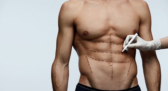 Six pack abs surgery cost in india