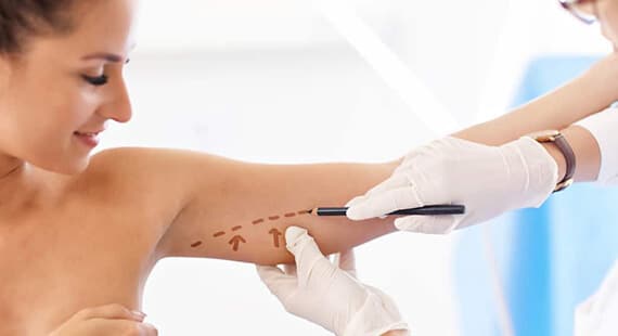 Arm Lift Surgery in Delhi