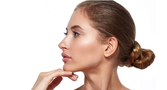 chin augmentation