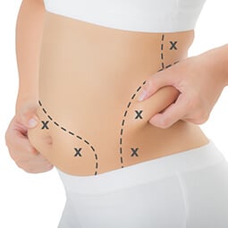 Tummy Tuck Surgery in Delhi