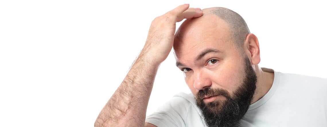 Hair Transplant Surgery
