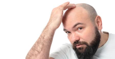 Hair Transplant Surgery