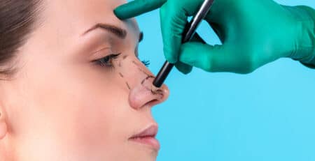 Nose Job - Rhinoplasty Surgery in delhi - Dr Rajat Gupta - Plastic Surgeon in Delhi