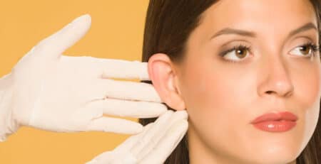 Otoplasty Surgery