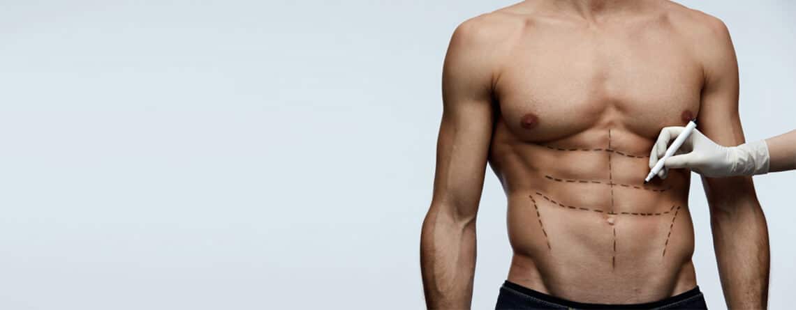 Six Packs Surgery for Men