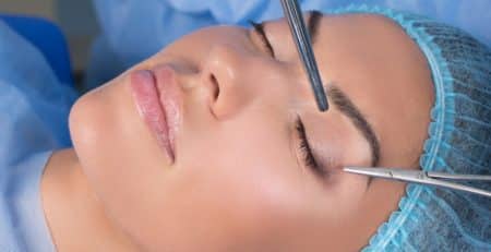 Blepharoplasty Surgery in Delhi