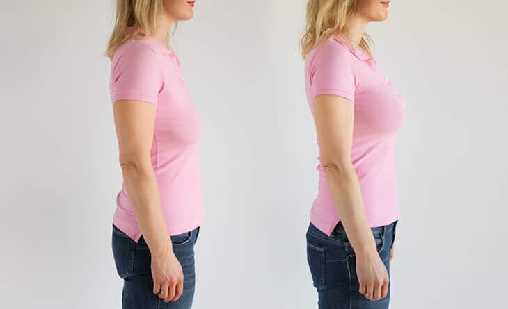 breast lift procedure