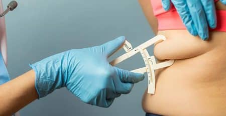 Liposuction Technique