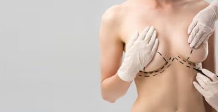 Breast Lift Surgery