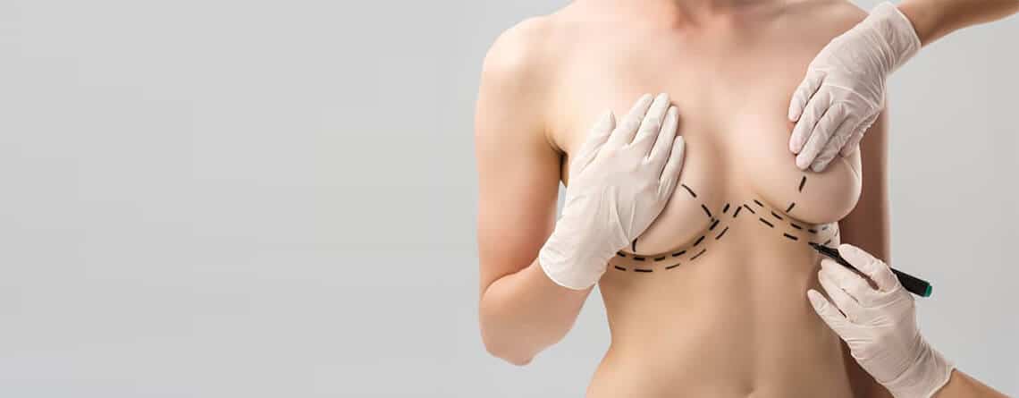 Breast Lift Surgery