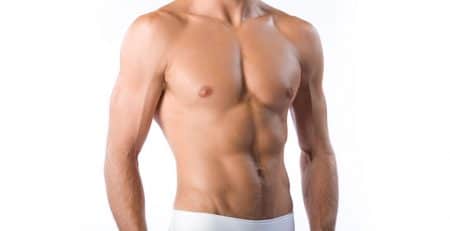 Gynecomastia
