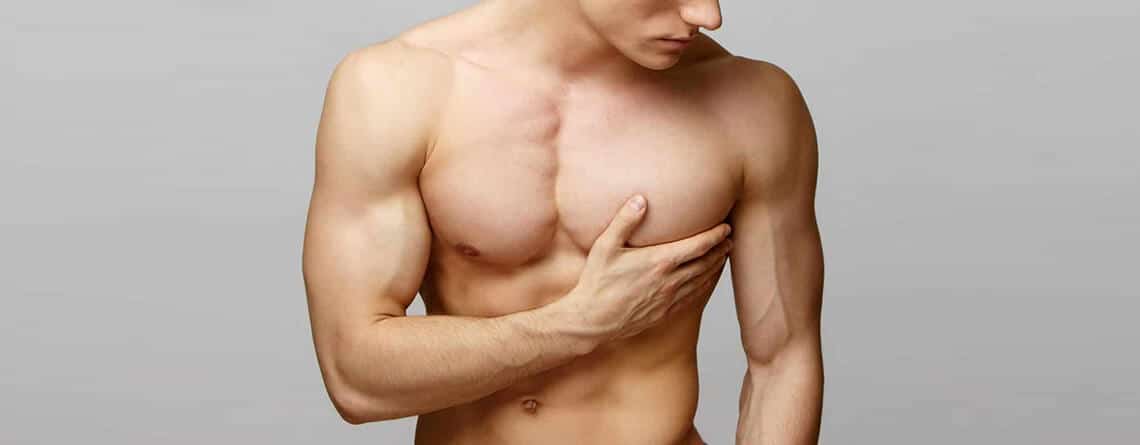 Gynecomastia