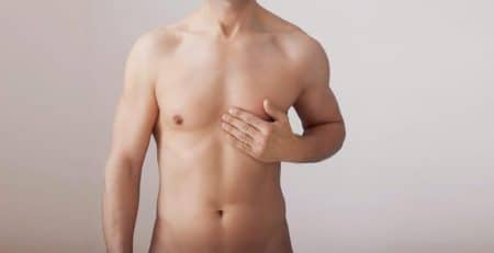 Gynecomastia Surgery in Delhi