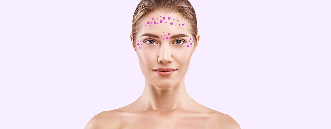 Botox – a medical boon - Dr Rajat Gupta - Plastic Surgeon in Delhi -03