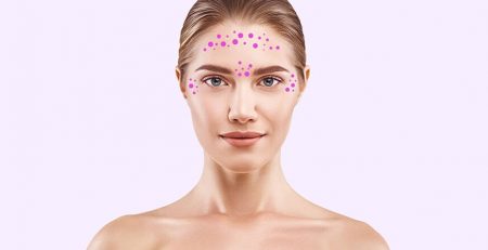 Botox – a medical boon - Dr Rajat Gupta - Plastic Surgeon in Delhi -03