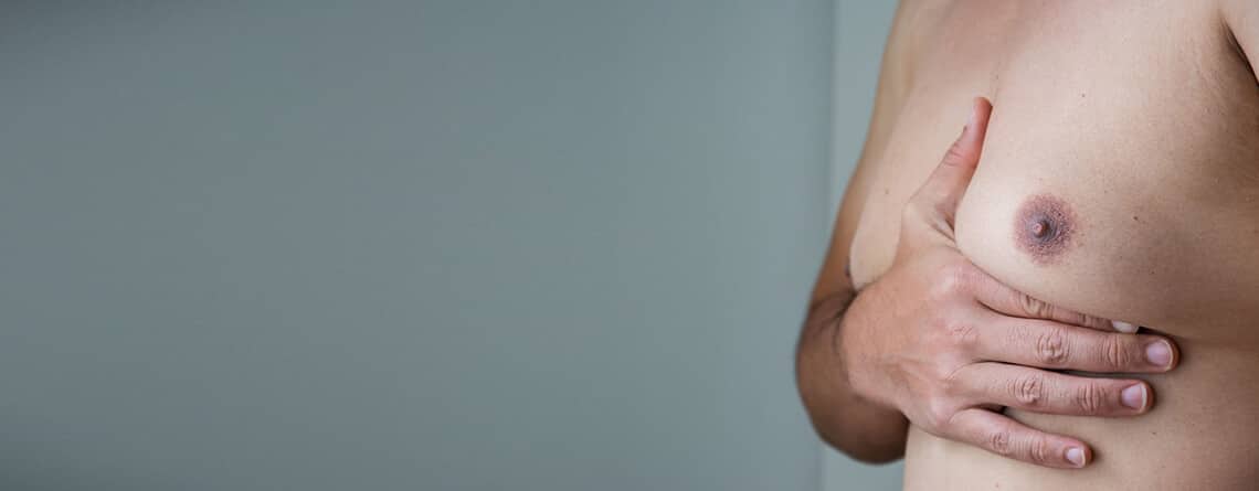 gynecomastia surgery in delhi