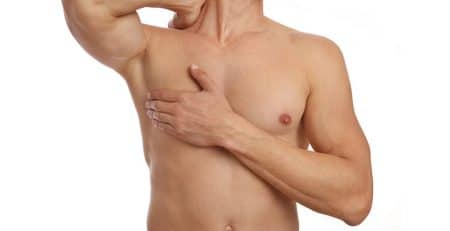 Gynecomastia Surgery
