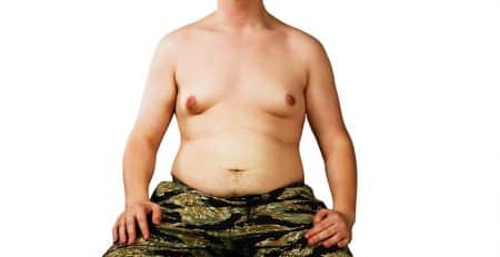 gynecomastia surgery in delhi