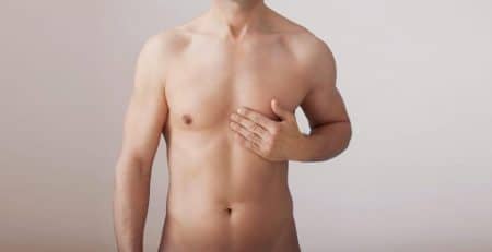 gynecomastia surgery in delhi