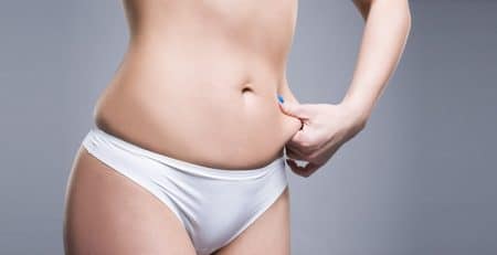 Liposuction surgery