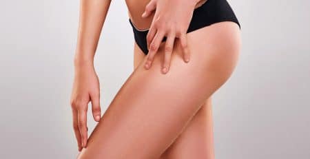 Liposuction surgery