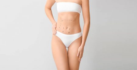 liposuction surgery in delhi