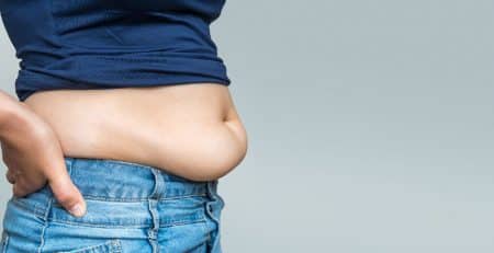 Tummy tuck surgery