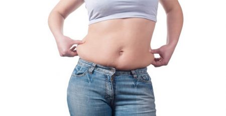 tummy tuck surgery