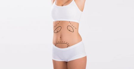 tummy tuck surgery in delhi