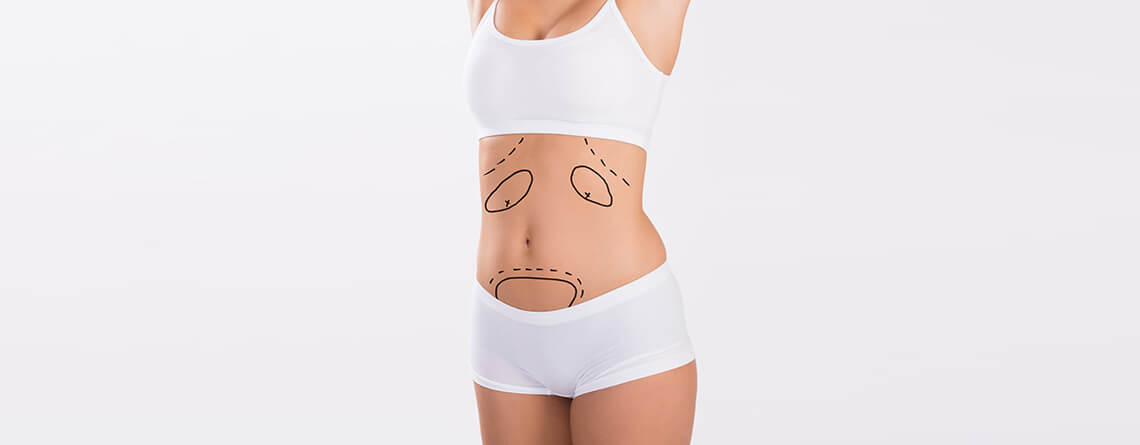 tummy tuck surgery in delhi