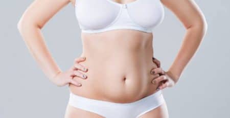 tummy tuck surgery