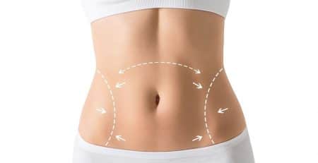 tummy tuck surgery in delhi