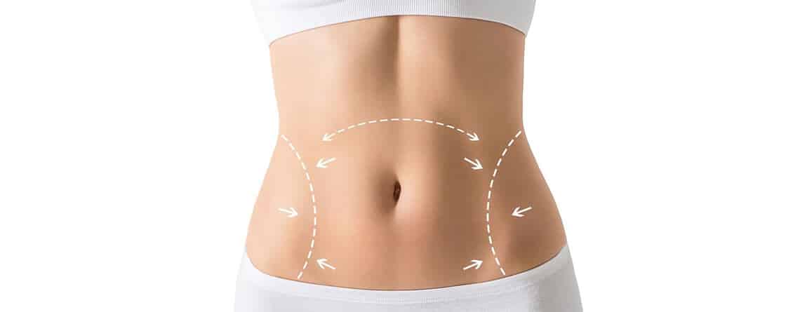 tummy tuck surgery in delhi