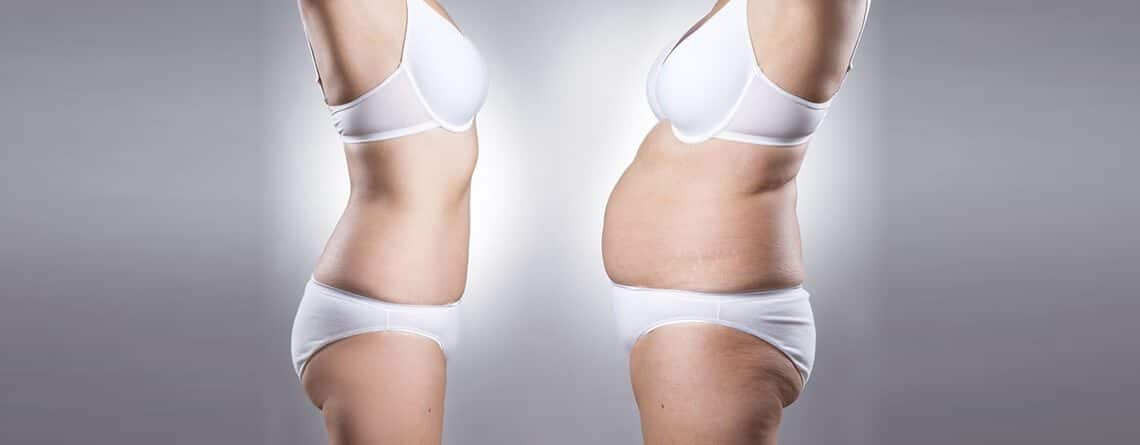 Mommy Makeover surgeon in Delhi