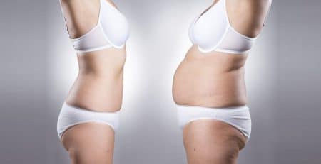 Mommy Makeover surgeon in Delhi