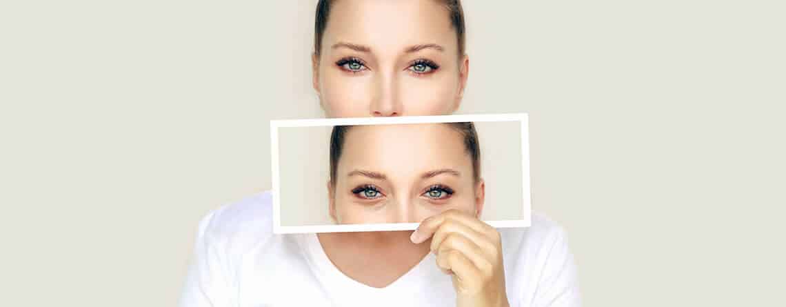 what is eyelid surgery