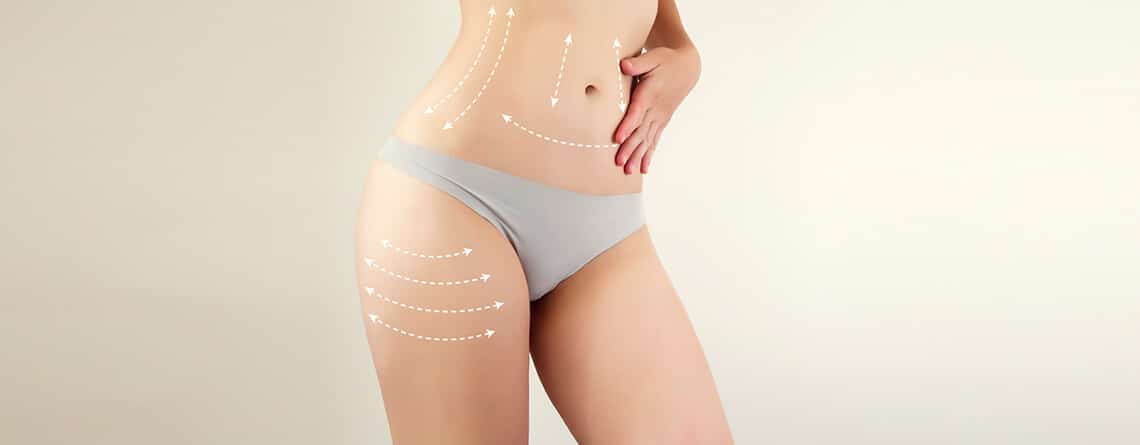 Liposuction Procedure