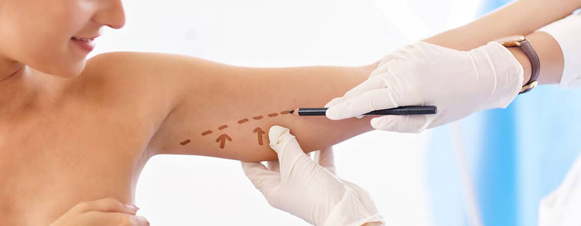 Arm Lift Procedure