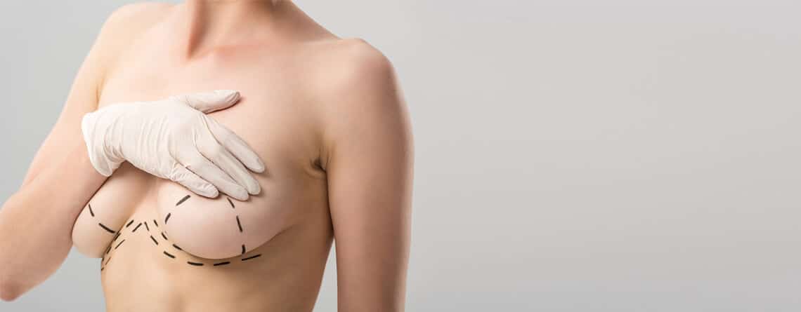 Breast Lift Procedure