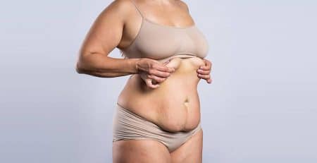 Tummy Tuck Procedure