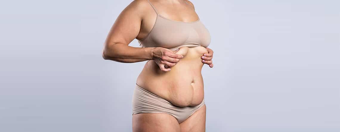 Tummy Tuck Procedure