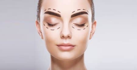 Blepharoplasty Surgery Procedure