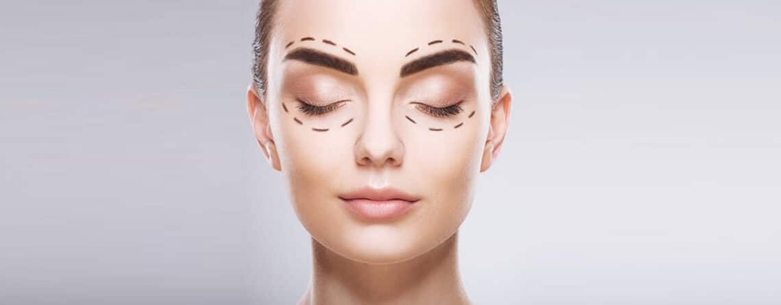 Blepharoplasty Surgery Procedure
