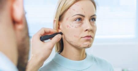 Face Lift Surgery Procedure
