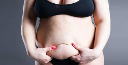 Tummy Tuck Procedure