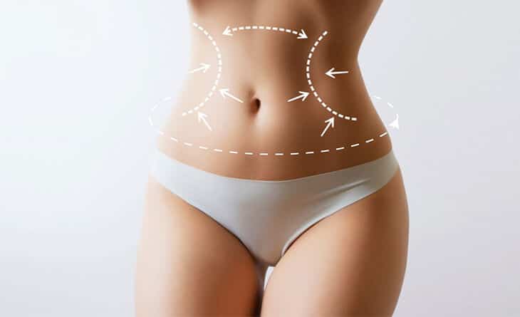 Liposuction procedure