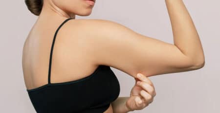 Arm Lift Procedure