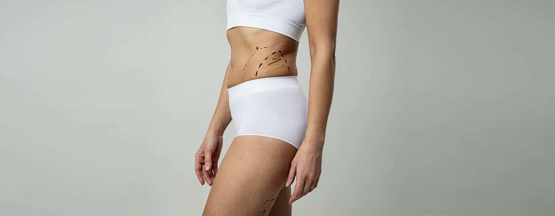 Liposuction procedure